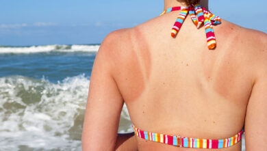 Sole e melanoma, la verità oltre la bufera social: cosa dice davvero la scienza