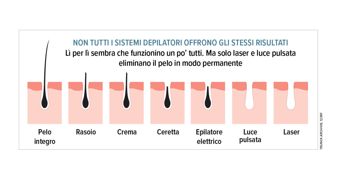 Peli addio! L’epilazione laser è sempre più hi-tech e su misura Peli addio! L’epilazione laser è sempre più hi-tech e su misura